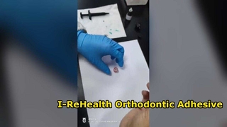Orthodontic Bonding System