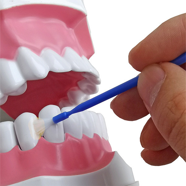 10g 5NaF Fluoride Varnish Apply To Tooth remineralization And Prevebts